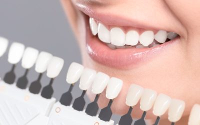 4 Impressive Benefits of Getting Dental Implants in Augusta, GA